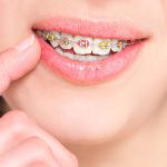 Fact that you don’t know about orthodontics