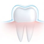 Treatments for Sensitive Teeth for cold